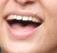 kitH