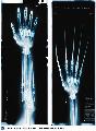 adamantium (karja)